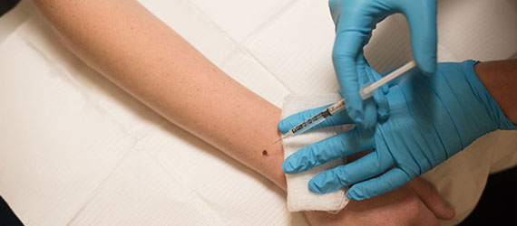 Regenerative Injection Therapy